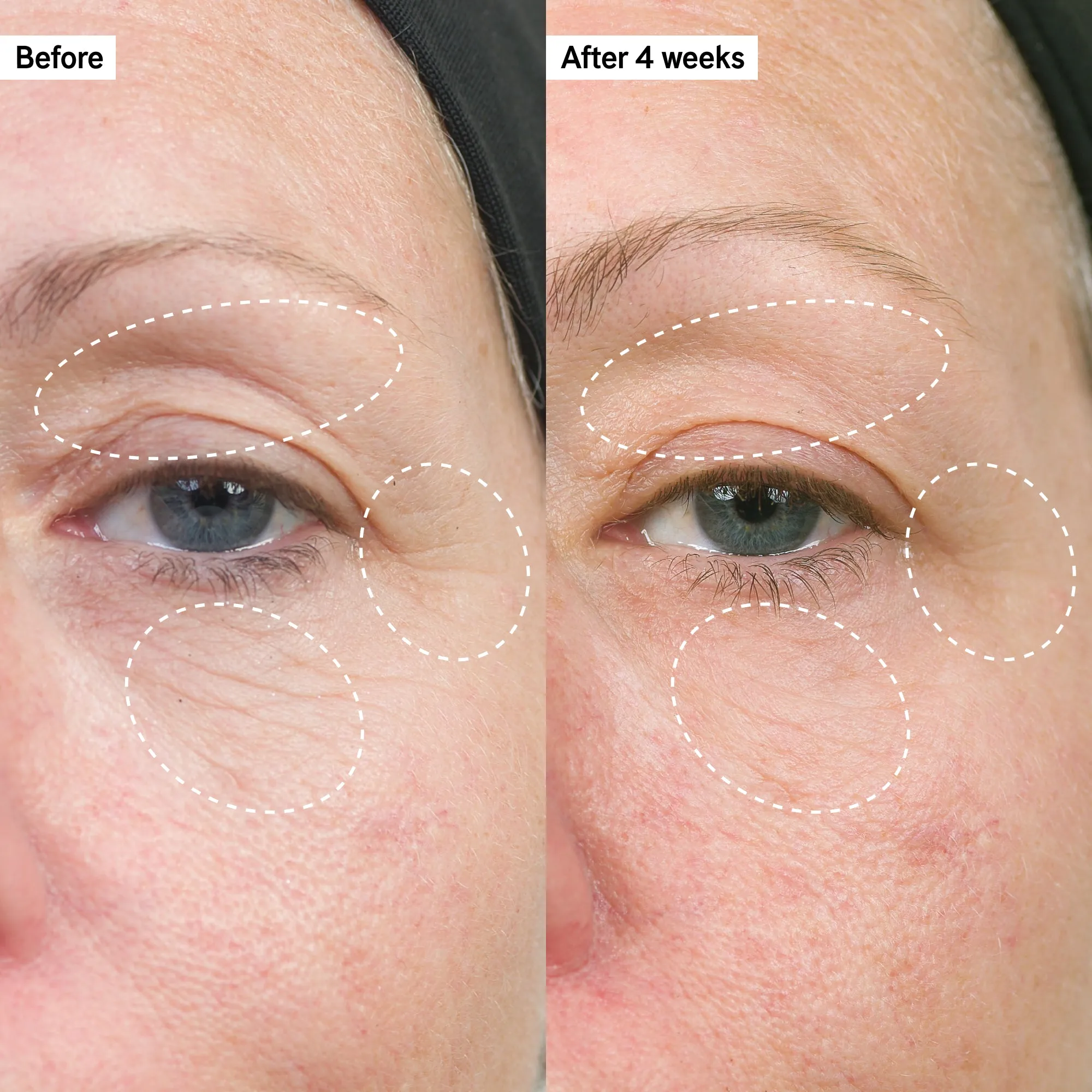 Fine Lines & Wrinkles Trio
