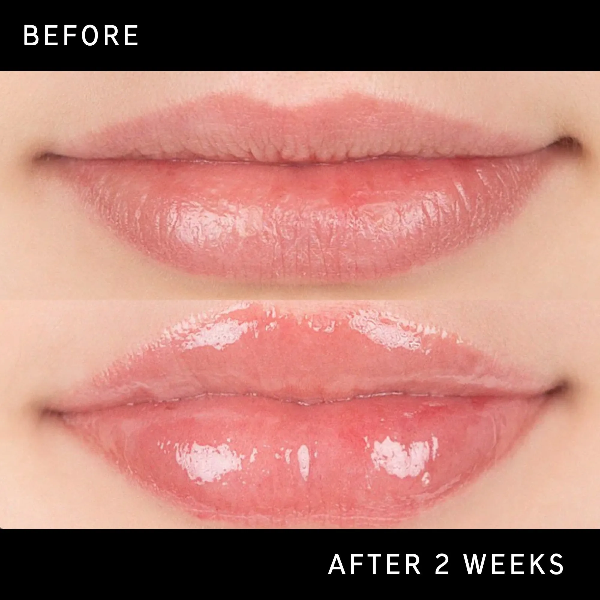 Lip Plumping Duo