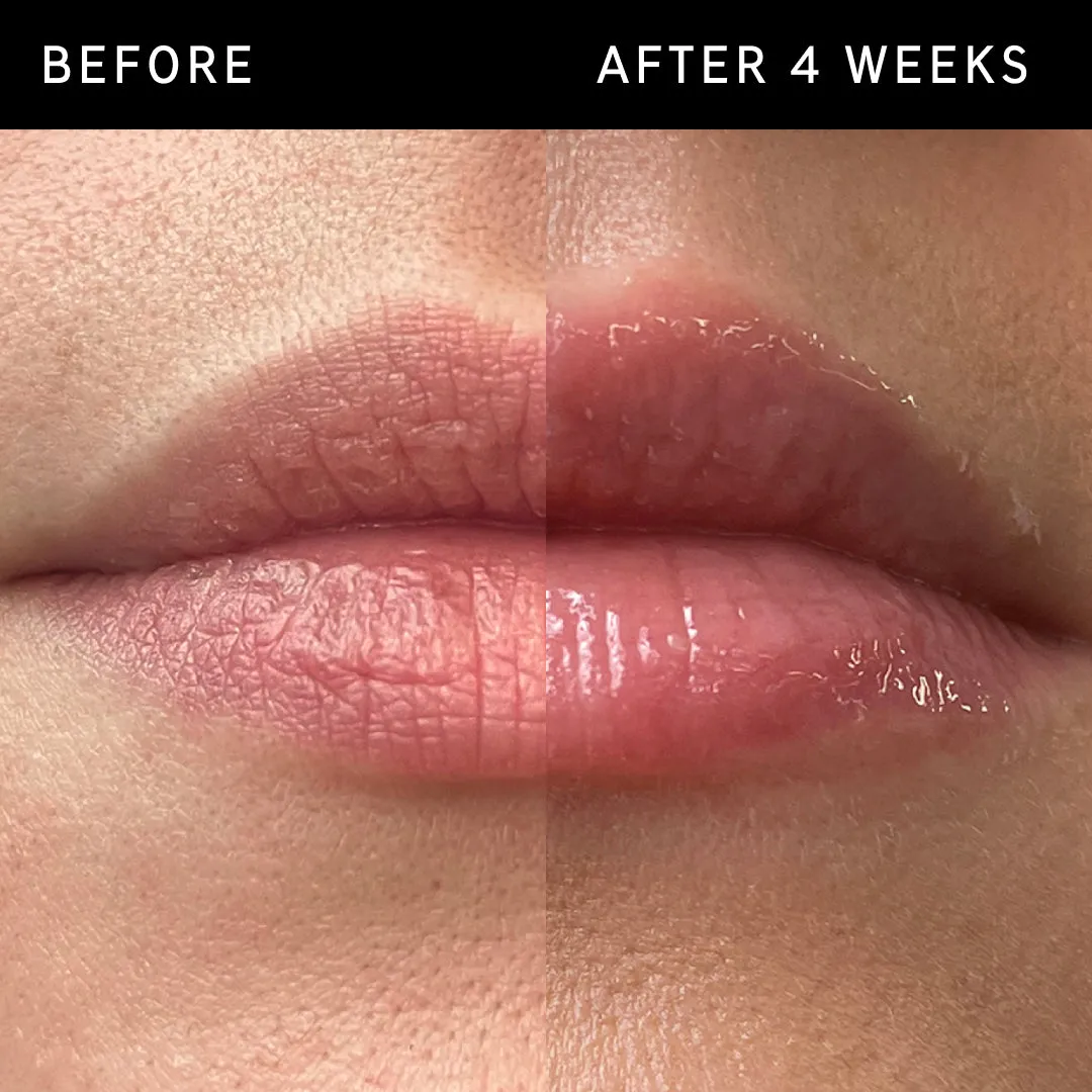 Lip Plumping Duo